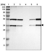 Anti-SCAMP2 antibody produced in rabbit Prestige Antibodies® Powered by Atlas Antibodies, affinity isolated antibody, buffered aqueous glycerol solution