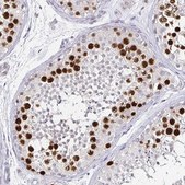 Monoclonal Anti-ANLN antibody produced in mouse Prestige Antibodies® Powered by Atlas Antibodies, clone CL0301, purified immunoglobulin, buffered aqueous glycerol solution