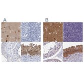 Anti-SRGAP3 antibody produced in rabbit Prestige Antibodies® Powered by Atlas Antibodies, affinity isolated antibody, buffered aqueous glycerol solution