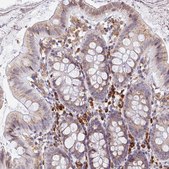 Anti-SSR4 antibody produced in rabbit affinity isolated antibody, buffered aqueous glycerol solution