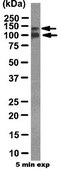 Anti-T-cadherin (CDH13) Antibody from rabbit, purified by affinity chromatography