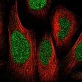 Anti-ZNF512 antibody produced in rabbit Prestige Antibodies® Powered by Atlas Antibodies, affinity isolated antibody, buffered aqueous glycerol solution