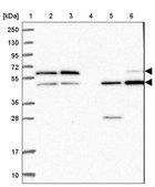 Anti-GDI1 antibody produced in rabbit Prestige Antibodies® Powered by Atlas Antibodies, affinity isolated antibody, buffered aqueous glycerol solution