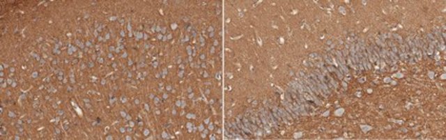 Anti-PTP zeta/Phosphacan from rabbit