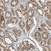 Anti-ITM2B antibody produced in rabbit Prestige Antibodies® Powered by Atlas Antibodies, affinity isolated antibody, buffered aqueous glycerol solution
