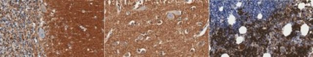 Anti-alpha-Synuclein Antibody, clone 9C4 clone 9C4, from mouse