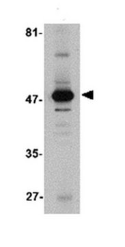Anti-Aldh3A1 Antibody from rabbit, purified by affinity chromatography