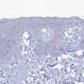 Anti-PPP1R14A antibody produced in rabbit Prestige Antibodies® Powered by Atlas Antibodies, affinity isolated antibody, buffered aqueous glycerol solution