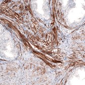 Monoclonal Anti-LAMA4 antibody produced in mouse Prestige Antibodies® Powered by Atlas Antibodies, clone CL3185, purified immunoglobulin, buffered aqueous glycerol solution