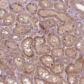 Anti-PARP3 antibody produced in rabbit Prestige Antibodies® Powered by Atlas Antibodies, affinity isolated antibody, buffered aqueous glycerol solution