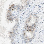 Anti-GDF15 antibody produced in rabbit Prestige Antibodies® Powered by Atlas Antibodies, affinity isolated antibody, buffered aqueous glycerol solution