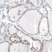 Anti-MAZ antibody produced in rabbit Prestige Antibodies® Powered by Atlas Antibodies, affinity isolated antibody, buffered aqueous glycerol solution