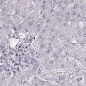 Anti-RP1L1 antibody produced in rabbit Prestige Antibodies® Powered by Atlas Antibodies, affinity isolated antibody