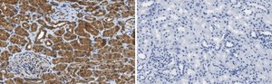 Anti-VEGF Receptor-3 Antibody, clone 9D9F9