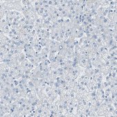 Anti-RPS12 antibody produced in rabbit Prestige Antibodies® Powered by Atlas Antibodies, affinity isolated antibody, buffered aqueous glycerol solution