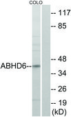 Anti-ABHD6 antibody produced in rabbit affinity isolated antibody