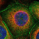 Anti-TP53BP2 antibody produced in rabbit Prestige Antibodies® Powered by Atlas Antibodies, affinity isolated antibody, buffered aqueous glycerol solution