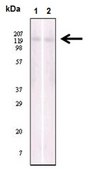 Anti-EPHB6, clone 8E7H12 Antibody clone 8E7H12, from mouse