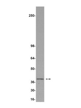 Anti-REA Antibody Upstate&#174;, from rabbit