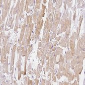 Anti-BATF antibody produced in rabbit Prestige Antibodies® Powered by Atlas Antibodies, affinity isolated antibody, buffered aqueous glycerol solution