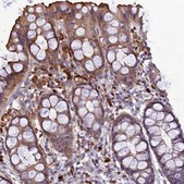 Anti-IRAK3 antibody produced in rabbit Prestige Antibodies® Powered by Atlas Antibodies, affinity isolated antibody, buffered aqueous glycerol solution