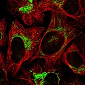 Anti-GTPBP8 antibody produced in rabbit Prestige Antibodies® Powered by Atlas Antibodies, affinity isolated antibody, buffered aqueous glycerol solution