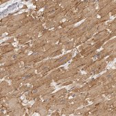 Anti-ADAMTS9 antibody produced in rabbit Prestige Antibodies® Powered by Atlas Antibodies, affinity isolated antibody, buffered aqueous glycerol solution, ab1