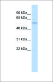 Anti-PPARD antibody produced in rabbit affinity isolated antibody