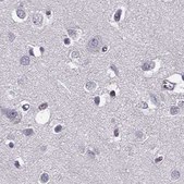 Anti-RP1L1 antibody produced in rabbit Prestige Antibodies® Powered by Atlas Antibodies, affinity isolated antibody