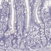Anti-GUCA1A antibody produced in rabbit Prestige Antibodies® Powered by Atlas Antibodies, affinity isolated antibody