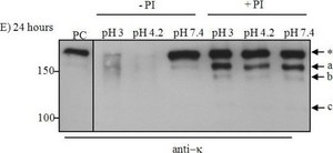 Anti-Human Kappa Light Chains (Bound and Free)−Peroxidase antibody produced in goat affinity isolated antibody, buffered aqueous solution