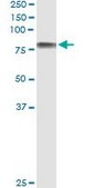 Monoclonal Anti-ICAM1 antibody produced in mouse clone 3H8-2G6, purified immunoglobulin, buffered aqueous solution
