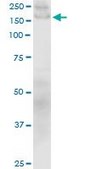 Monoclonal Anti-COL1A1 antibody produced in mouse clone 3G3, purified immunoglobulin, buffered aqueous solution