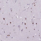 Anti-MEF2C antibody produced in rabbit Prestige Antibodies® Powered by Atlas Antibodies, affinity isolated antibody, buffered aqueous glycerol solution