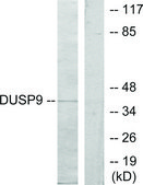 Anti-DUSP9 antibody produced in rabbit affinity isolated antibody