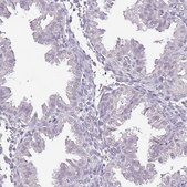 Anti-IZUMO4 antibody produced in rabbit Prestige Antibodies® Powered by Atlas Antibodies, affinity isolated antibody, buffered aqueous glycerol solution