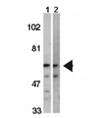 Anti-IRAK-2 Antibody from rabbit, purified by affinity chromatography