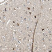 Anti-ROCK2 antibody produced in rabbit Prestige Antibodies® Powered by Atlas Antibodies, affinity isolated antibody, buffered aqueous glycerol solution