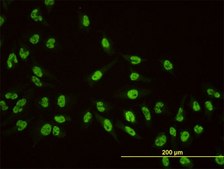 Monoclonal Anti-AKAP8 antibody produced in mouse clone 3D4, purified immunoglobulin, buffered aqueous solution