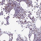 Anti-RPS6KB1 antibody produced in rabbit Prestige Antibodies® Powered by Atlas Antibodies, affinity isolated antibody, buffered aqueous glycerol solution