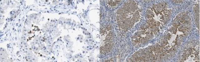anti glutathione antibody Sigma-Aldrich Anti-Glutathione Reductase antibody, Mouse monoclonal, clone GR6, purified from hybridoma cell culture 200 uL Mouse monoclonal Glutathione antibody [D8] Glutathione inhibits antibody and complement-mediated