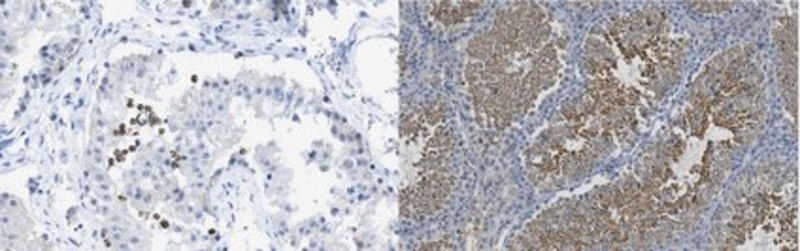glutathione peroxidase monoclonal antibody 4 (E5Y8K) Rabbit mAb Suitable for WB and reacts with Mouse Anti-Glutathione Peroxidase 1 antibody [EPR3311]