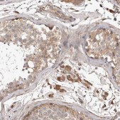 Anti-CDC42BPB antibody produced in rabbit Prestige Antibodies® Powered by Atlas Antibodies, affinity isolated antibody, buffered aqueous glycerol solution