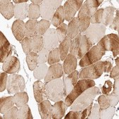 Anti-PPP1R3B antibody produced in rabbit Prestige Antibodies® Powered by Atlas Antibodies, affinity isolated antibody, buffered aqueous glycerol solution