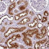 Anti-ATP6V1D antibody produced in rabbit Prestige Antibodies® Powered by Atlas Antibodies, affinity isolated antibody, buffered aqueous glycerol solution