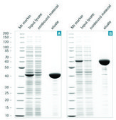 cOmplete™ His-タグ精製樹脂 suspension, suitable for protein purification, matrix Sepharose-CL 6B