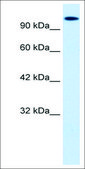 Anti-HIPK2 antibody produced in rabbit affinity isolated antibody