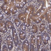 Anti-WASHC1 antibody produced in rabbit Prestige Antibodies® Powered by Atlas Antibodies, affinity isolated antibody, buffered aqueous glycerol solution