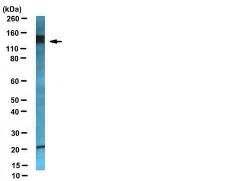 Anti-Neuropilin-2 Antibody serum, from rabbit