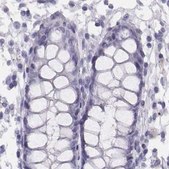 Anti-HIST1H1T antibody produced in rabbit Prestige Antibodies® Powered by Atlas Antibodies, affinity isolated antibody
